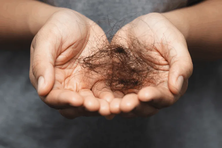 does smoking cause hair loss